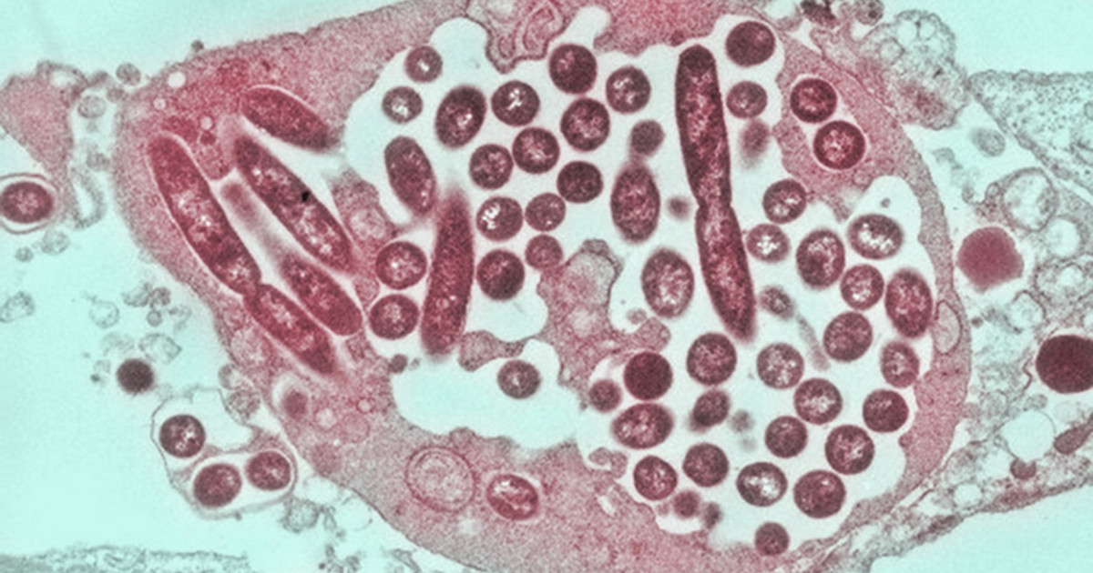O bacterie periculoasă face ravagii într-un oraş din sudul Poloniei. 5 oameni au murit, câteva zeci au ajuns la spital